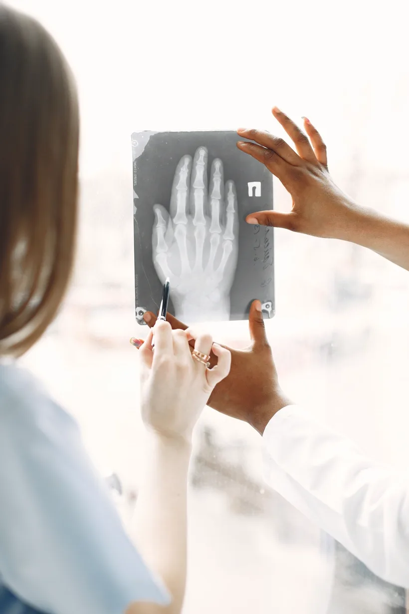 Radiografia de mão analisada durante a consulta
