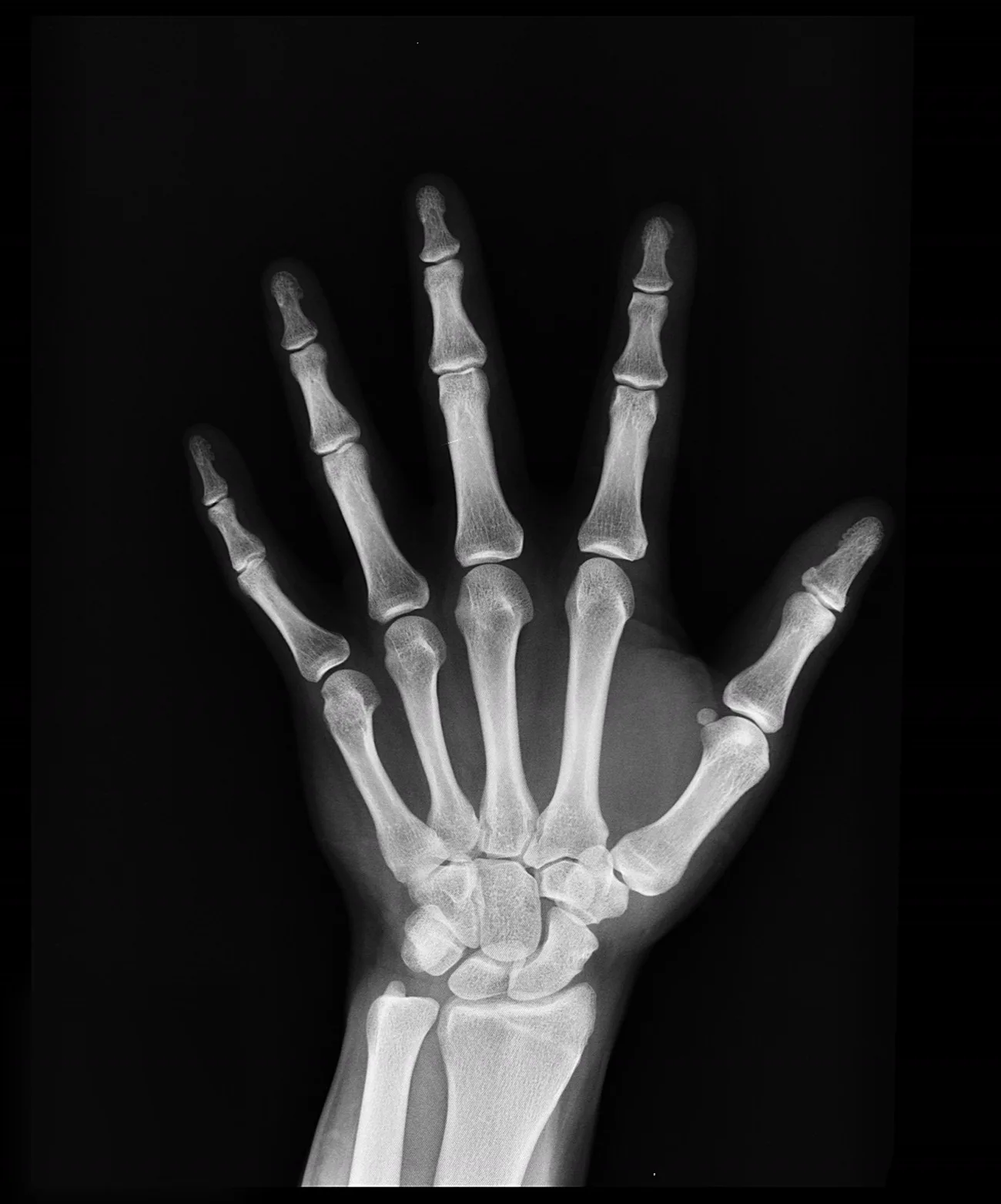 Radiografia de uma mão, com as articulações visíveis